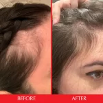 قرص تقویت کننده مو هیرتامین