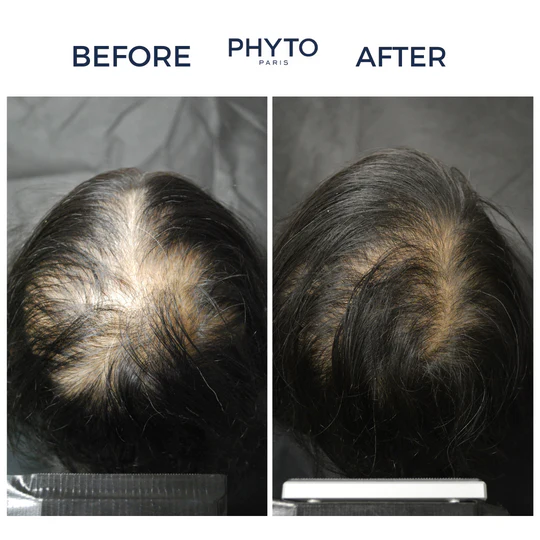 شامپو ضد ریزش بانوان فیتوسیان حجم 250 میل